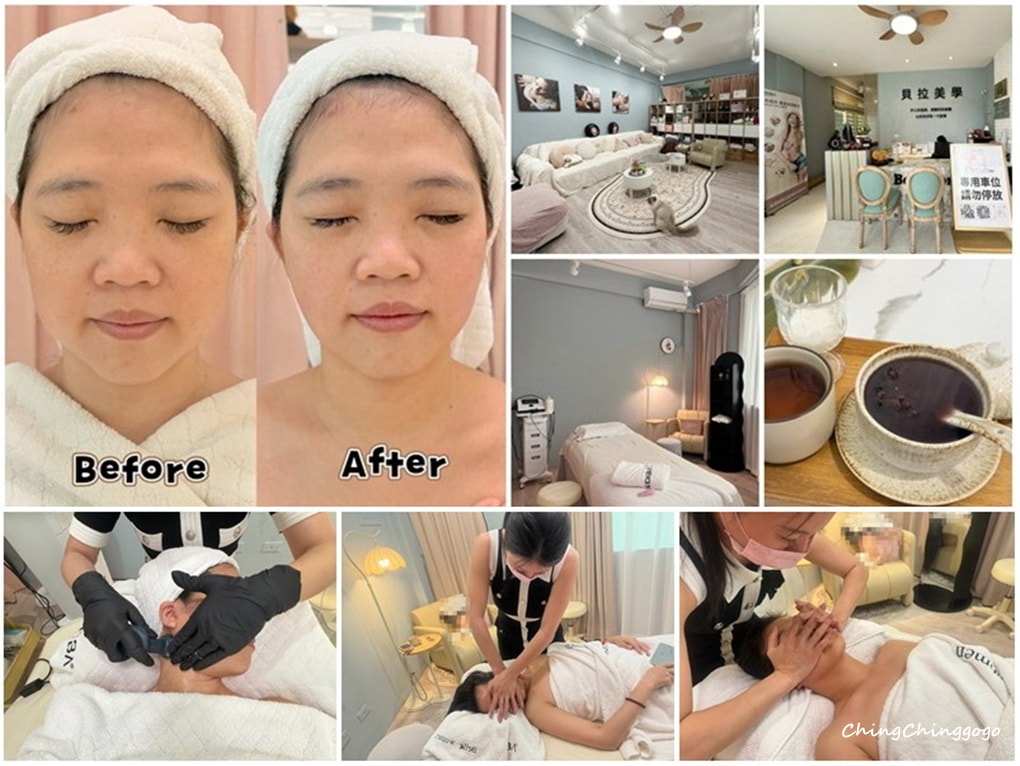 竹北貝拉美學SPA-INDIBA英特波生活美容館|小臉緊緻優惠&加碼|全預約制
